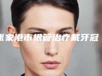 张家港市根管治疗戴牙冠价位表官方公开曝光-张家港市根管治疗戴牙冠价格