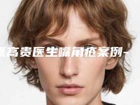 张高贵医生嘴角疮案例-价格(费用)清单2025版在这里