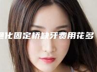 通化固定桥缺牙费用花多少