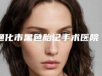 通化市黑色胎记手术医院排名榜十强一览表查收（通化市黑色胎记手术整形医院）