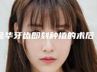 金华牙齿即刻种植的术后效果好吗