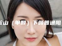 鞍山（单颗）下颌普通阻生智齿拔除会影响生育能力吗