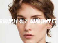 鞍鼻是什么？鼻部治疗方式有哪些？
