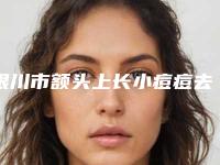 银川市额头上长小痘痘去除整形医院在榜名单专业技术强，口碑好(银川慧清雅妍整形医疗美容门诊部TOP10稳中求胜)