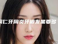 铜仁牙周炎牙根发黑要多少钱，效果如何