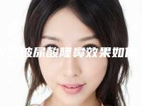 长沙玻尿酸隆鼻效果如何（玻尿酸隆鼻效果好吗）