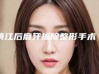 镇江后磨牙拔除整形手术效果怎样