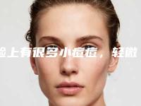 脸上有很多小痘痘，轻微发红_宝宝从六个多月的时候长出几个痘痘，现在!