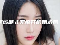 聊城韩式无痕开眼角术后护理主要包括哪几个方面