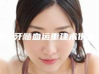 肇庆牙髓血运重建术伤害皮肤吗