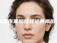 自贡市黑脸娃娃祛黄褐斑医院信息 价格表2025(2025年5月均价为：1644元）