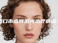 营口市点阵激光治疗病价格(收费标准)超火出炉（营口市点阵激光治疗病大概什么价格）