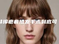 蚌埠疤痕植发手术到底可以保持多长时间