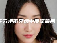 连云港市牙齿中度深覆合正畸医院排名榜选出前六对比挑选（连云港市牙齿中度深覆合正畸口腔医院在榜内）