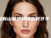 马鞍山前牙种植临时牙手术可以维持多长时间