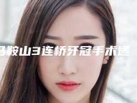 马鞍山3连桥牙冠手术适合的人群