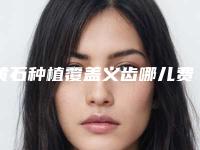 黄石种植覆盖义齿哪儿费用实惠