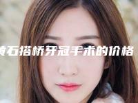 黄石搭桥牙冠手术的价格会受到那些因素影响