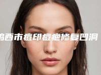 鸡西市痘印痘疤修复凹洞整形医院(鸡西董迎杰医疗美容皮肤科诊所一起来瞧瞧实力高低~)